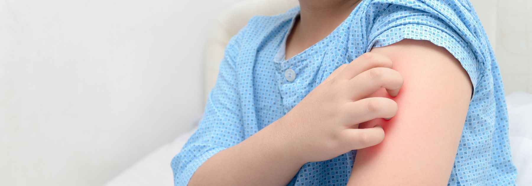 impetigo pharmacy first